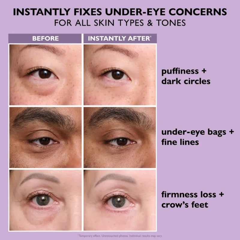 🎉60% off🎉 Eye Tightener