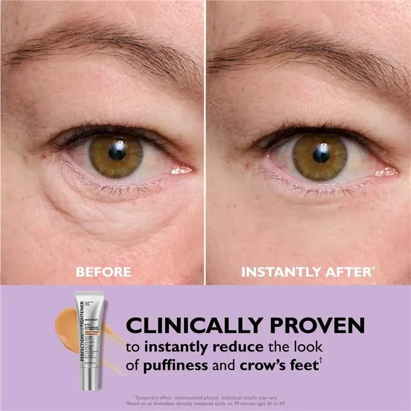🎉60% off🎉 Eye Tightener
