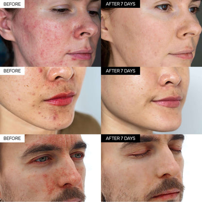 Intensive Cica Repair Cream