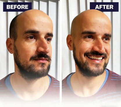 Effortless Head Shaving: Must-Have Shaver For Bald Guys