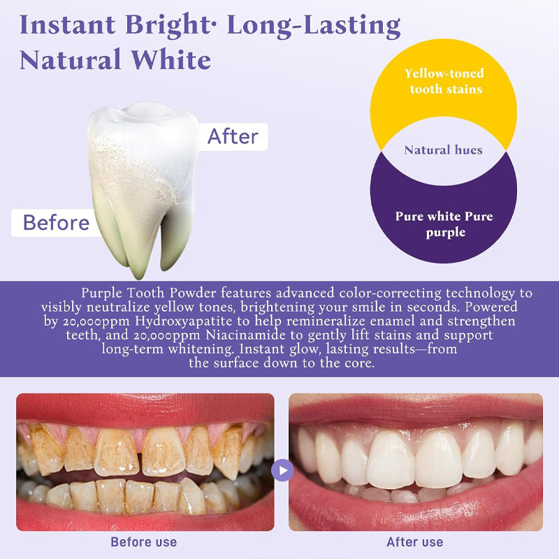 Final 3 Hours: 80% OFF 🔥Teeth Whitening Powder