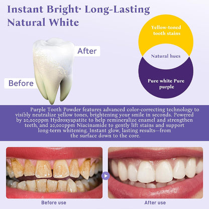 Final 3 Hours: 80% OFF 🔥Teeth Whitening Powder